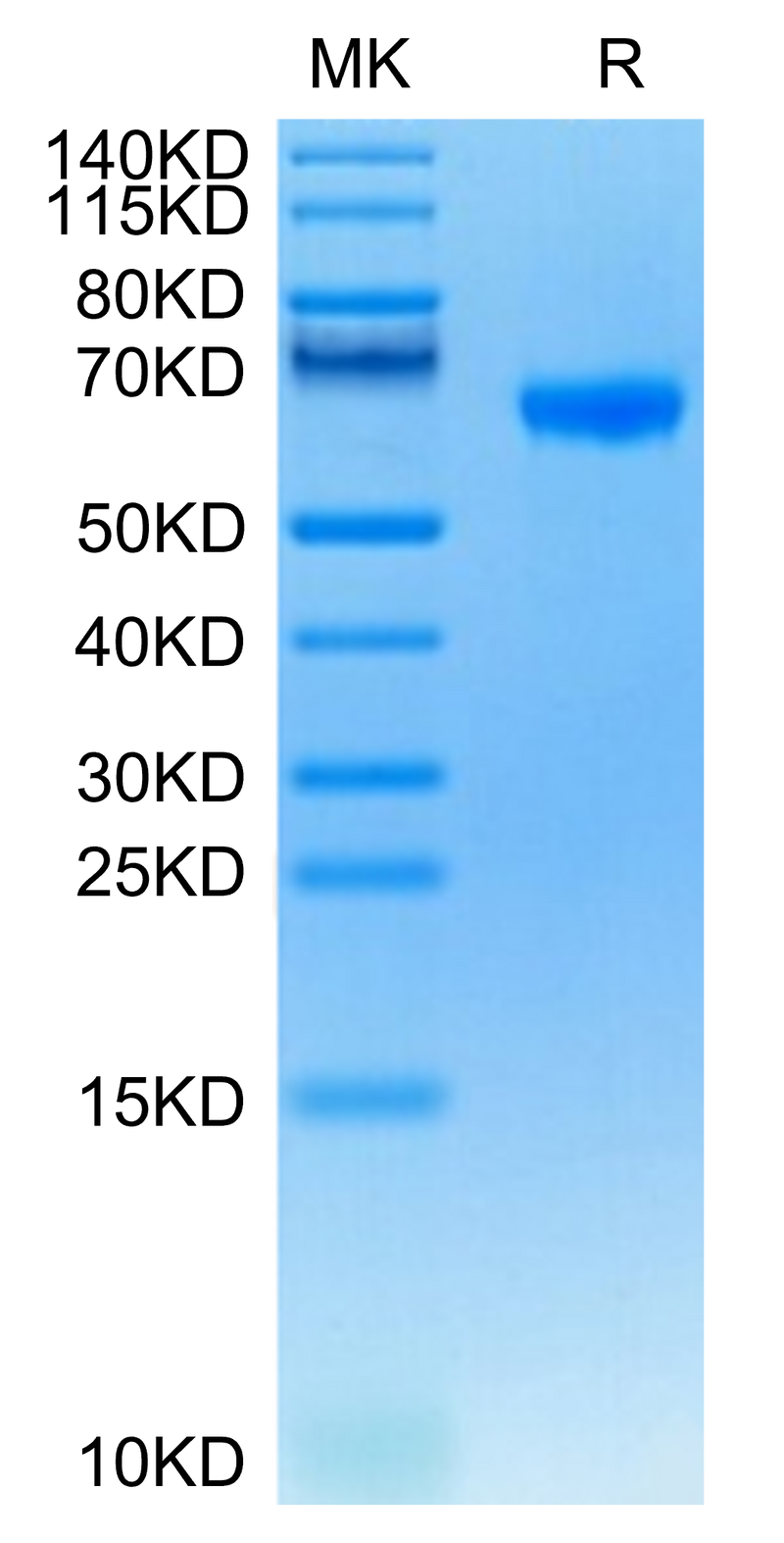 Human FCRL2 on Tris-Bis PAGE under reduced condition. The purity is greater than 95%.