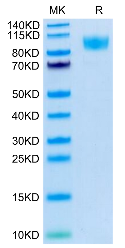 Human CD45 on Tris-Bis PAGE under reduced condition. The purity is greater than 95%.Recombinant Human CD45/PTPRC Protein, Active