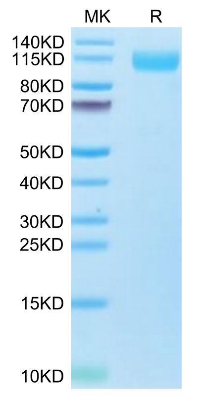 Biotinylated SARS-COV-2 Spike S1 (Omicron B.1.1.529) on Tris-Bis PAGE under reduced condition. The purity is greater than 95%.Biotinylated SARS-COV-2 Spike S1 (Omicron B.1.1.529) Protein, Active