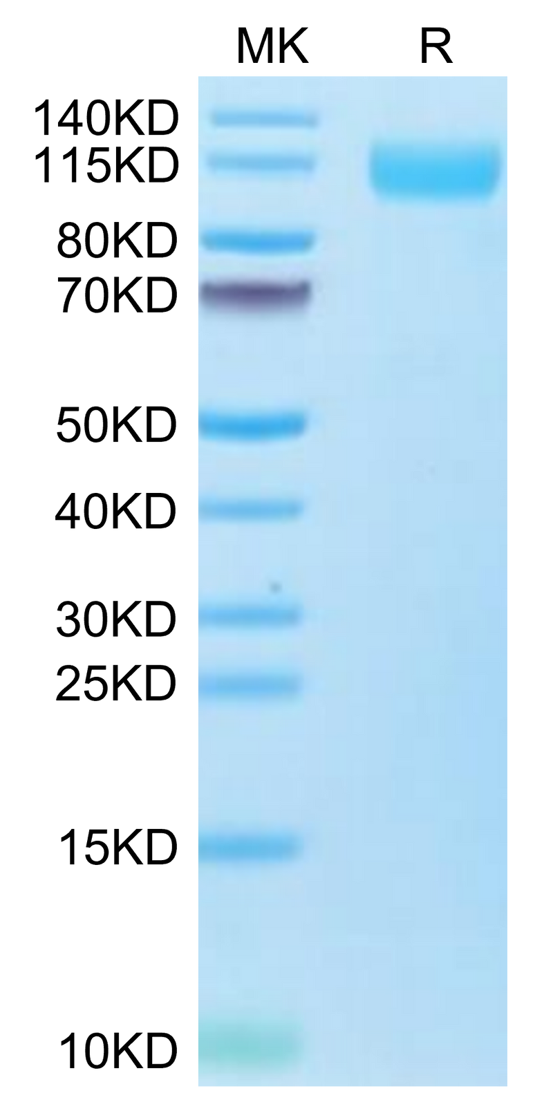 Biotinylated SARS-COV-2 Spike S1 (Omicron B.1.1.529) on Tris-Bis PAGE under reduced condition. The purity is greater than 95%.Biotinylated SARS-COV-2 Spike S1 (Omicron B.1.1.529) Protein, Active
