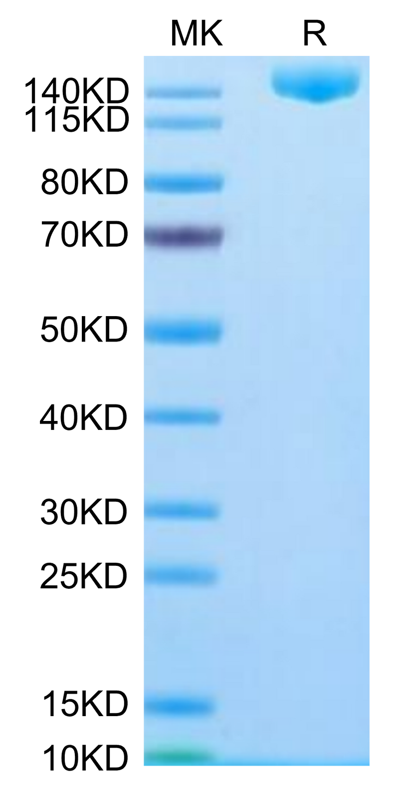 SARS-COV-2 Spike S (Omicron B.1.1.529) Trimer on Tris-Bis PAGE under reduced condition. The purity is greater than 95%.Recombinant SARS-COV-2 Spike S (Omicron B.1.1.529) Trimer Protein, Active