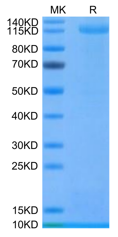 Mouse ALK on Tris-Bis PAGE under reduced condition. The purity is greater than 95%.Recombinant Mouse ALK Protein