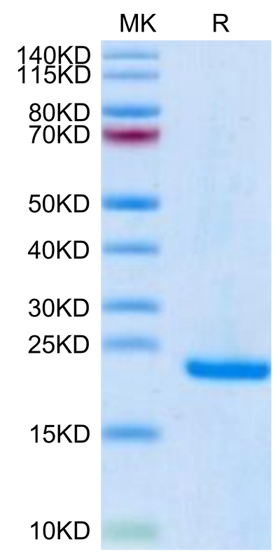 Human Midkine on Tris-Bis PAGE under reduced condition. The purity is greater than 95%.Recombinant Human Midkine Protein
