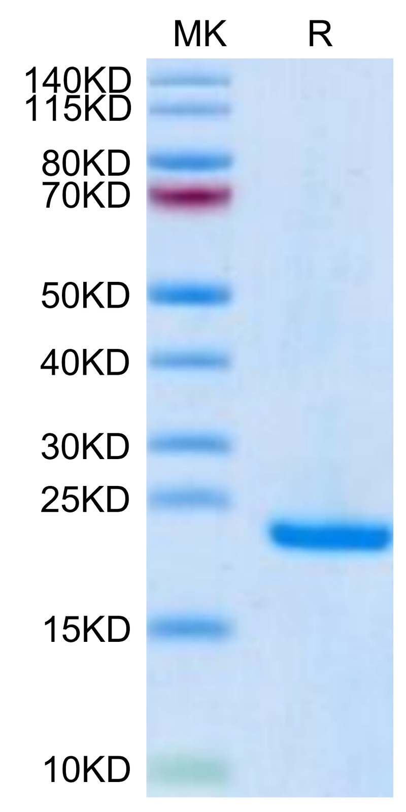 Human Midkine on Tris-Bis PAGE under reduced condition. The purity is greater than 95%.Recombinant Human Midkine Protein