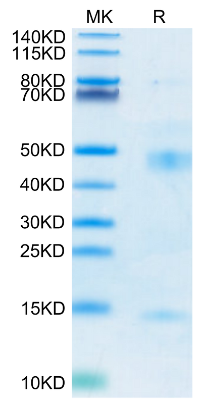 Mouse Latent TGF beta 1 on Tris-Bis PAGE under reduced condition. The purity is greater than 95%.Recombinant Mouse Latent TGF beta 1/TGFB1 Protein, Active