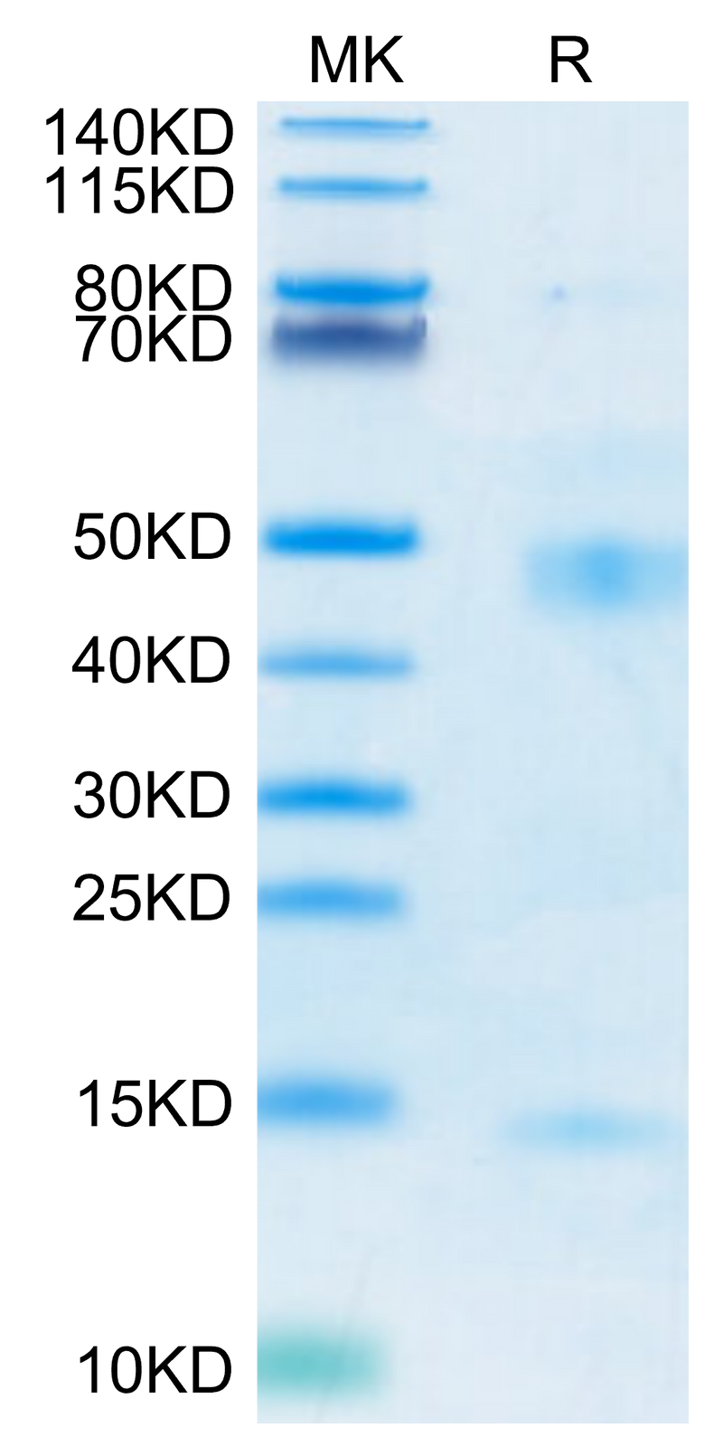 Mouse Latent TGF beta 1 on Tris-Bis PAGE under reduced condition. The purity is greater than 95%.