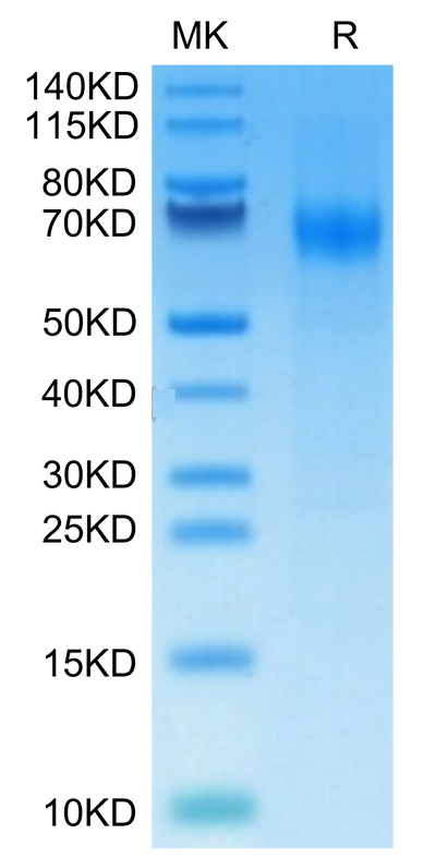 Mouse IFNAR1 on Tris-Bis PAGE under reduced condition. The purity is greater than 95%.Recombinant Mouse IFN alpha/beta R1 Protein, Active