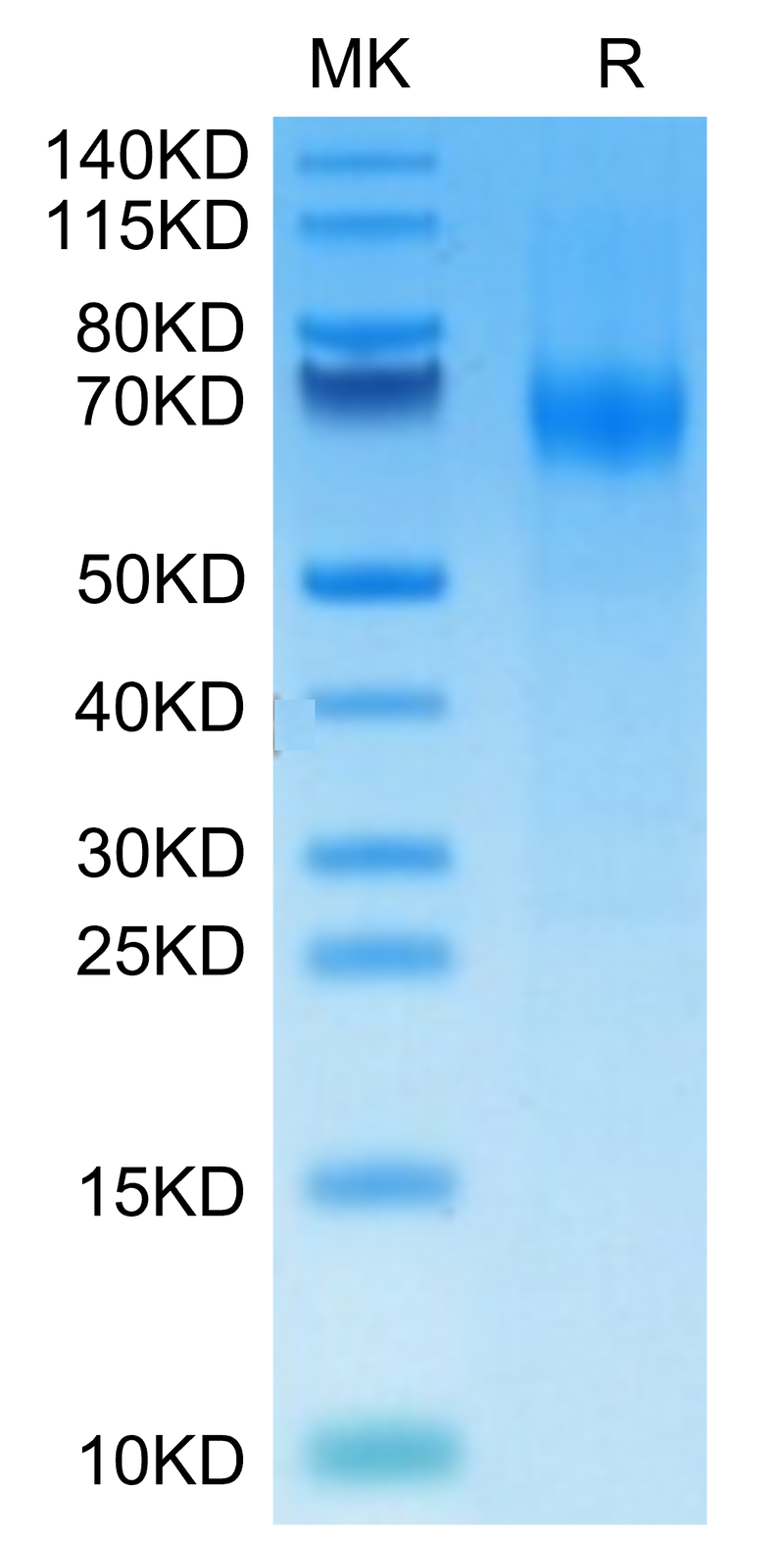 Mouse IFNAR1 on Tris-Bis PAGE under reduced condition. The purity is greater than 95%.Recombinant Mouse IFN alpha/beta R1 Protein, Active