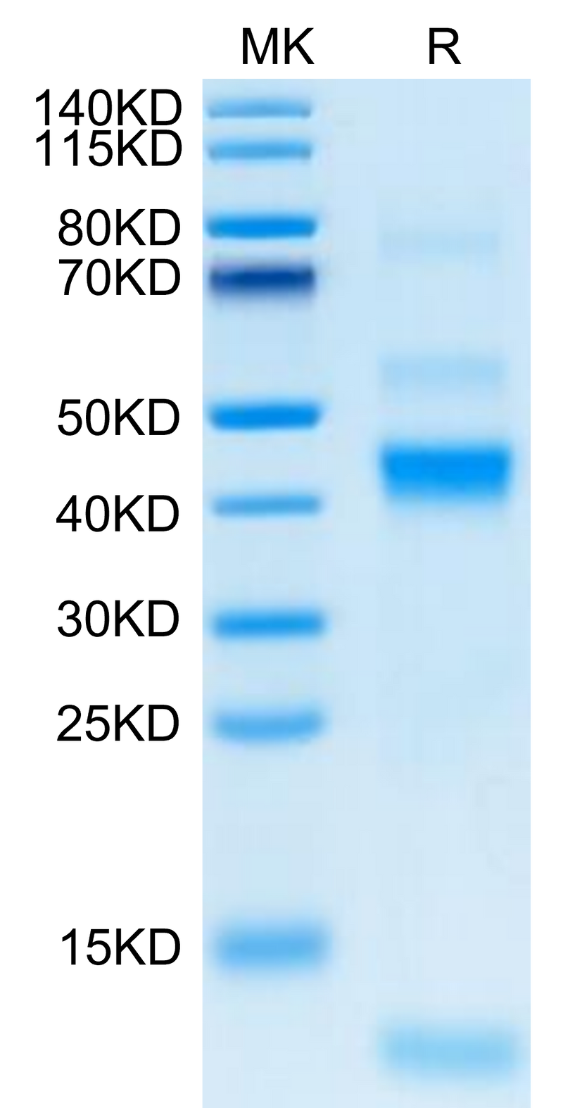 Rhesus macaque Latent TGF beta 1 on Tris-Bis PAGE under reduced condition. The purity is greater than 95%.Recombinant Rhesus macaque Latent TGF beta 1/TGFB1 Protein, Active