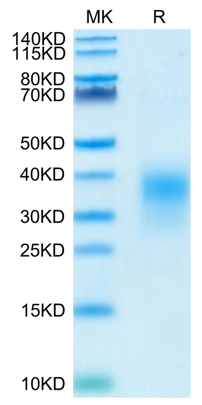 Human ICOS (C136S,C137S) on Tris-Bis PAGE under reduced condition. The purity is greater than 95%.Recombinant Human ICOS/CD278 (C136S, C137S) Protein, Active