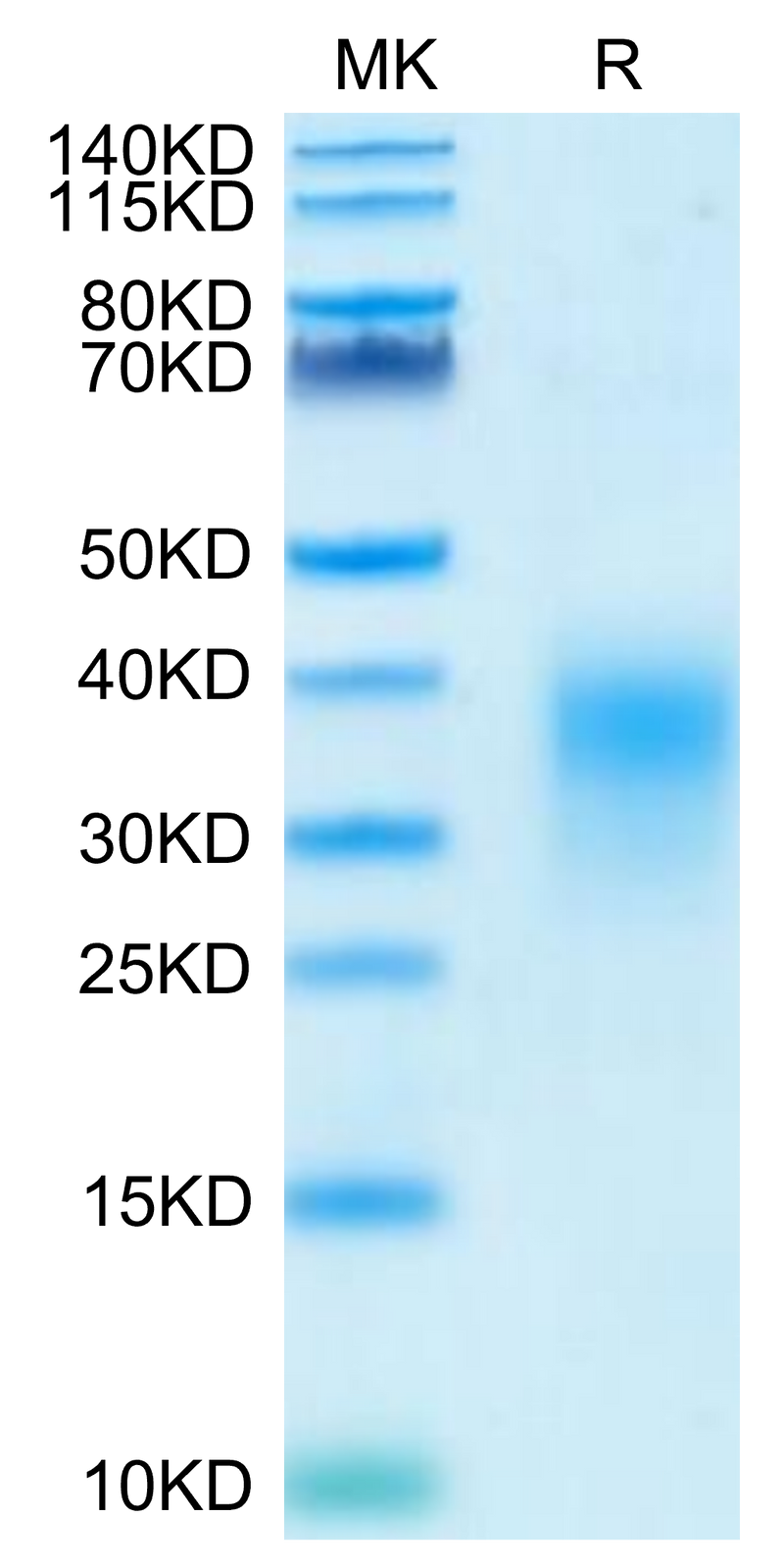 Human ICOS (C136S,C137S) on Tris-Bis PAGE under reduced condition. The purity is greater than 95%.Recombinant Human ICOS/CD278 (C136S, C137S) Protein, Active