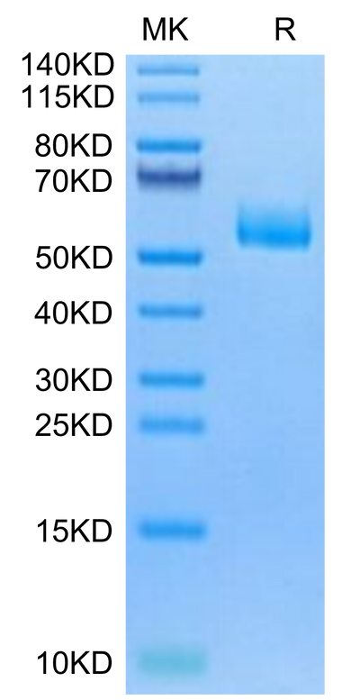 Human CPM on Tris-Bis PAGE under reduced condition. The purity is greater than 95%.Recombinant Human CPM Protein