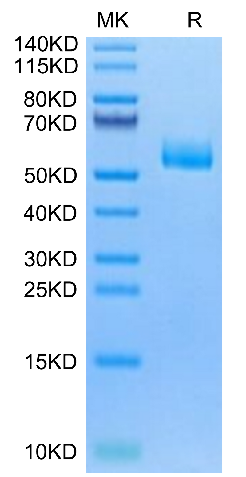 Human CPM on Tris-Bis PAGE under reduced condition. The purity is greater than 95%.Recombinant Human CPM Protein