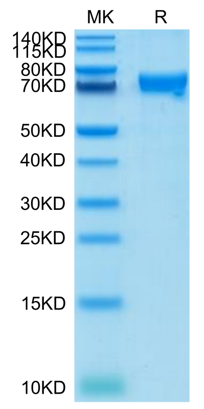 Cynomolgus CRTAM on Tris-Bis PAGE under reduced condition. The purity is greater than 95%.Recombinant Cynomolgus CRTAM Protein, Active