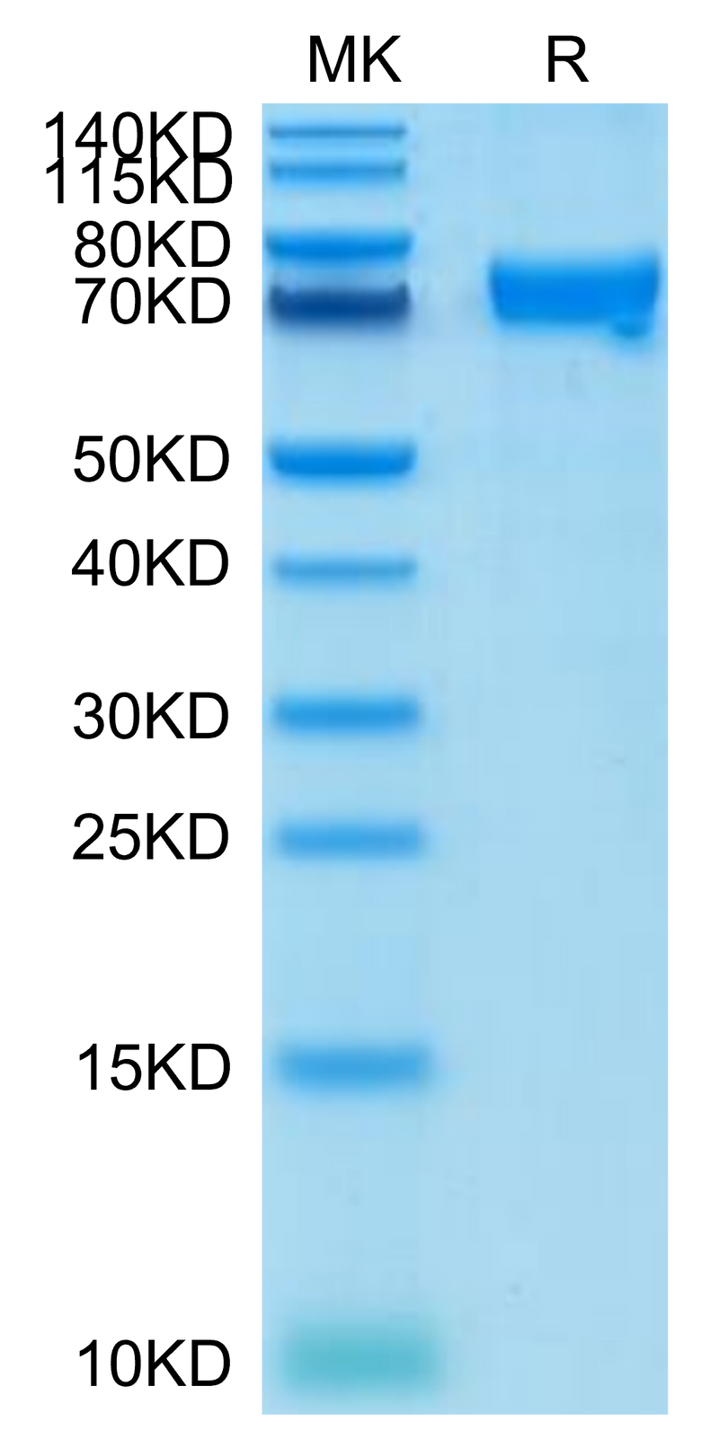Cynomolgus CRTAM on Tris-Bis PAGE under reduced condition. The purity is greater than 95%.Recombinant Cynomolgus CRTAM Protein, Active