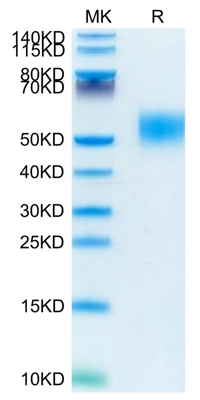 Mouse GM-CSF R alpha on Tris-Bis PAGE under reduced condition. The purity is greater than 95%.Recombinant Mouse GM-CSF R alpha Protein, Active
