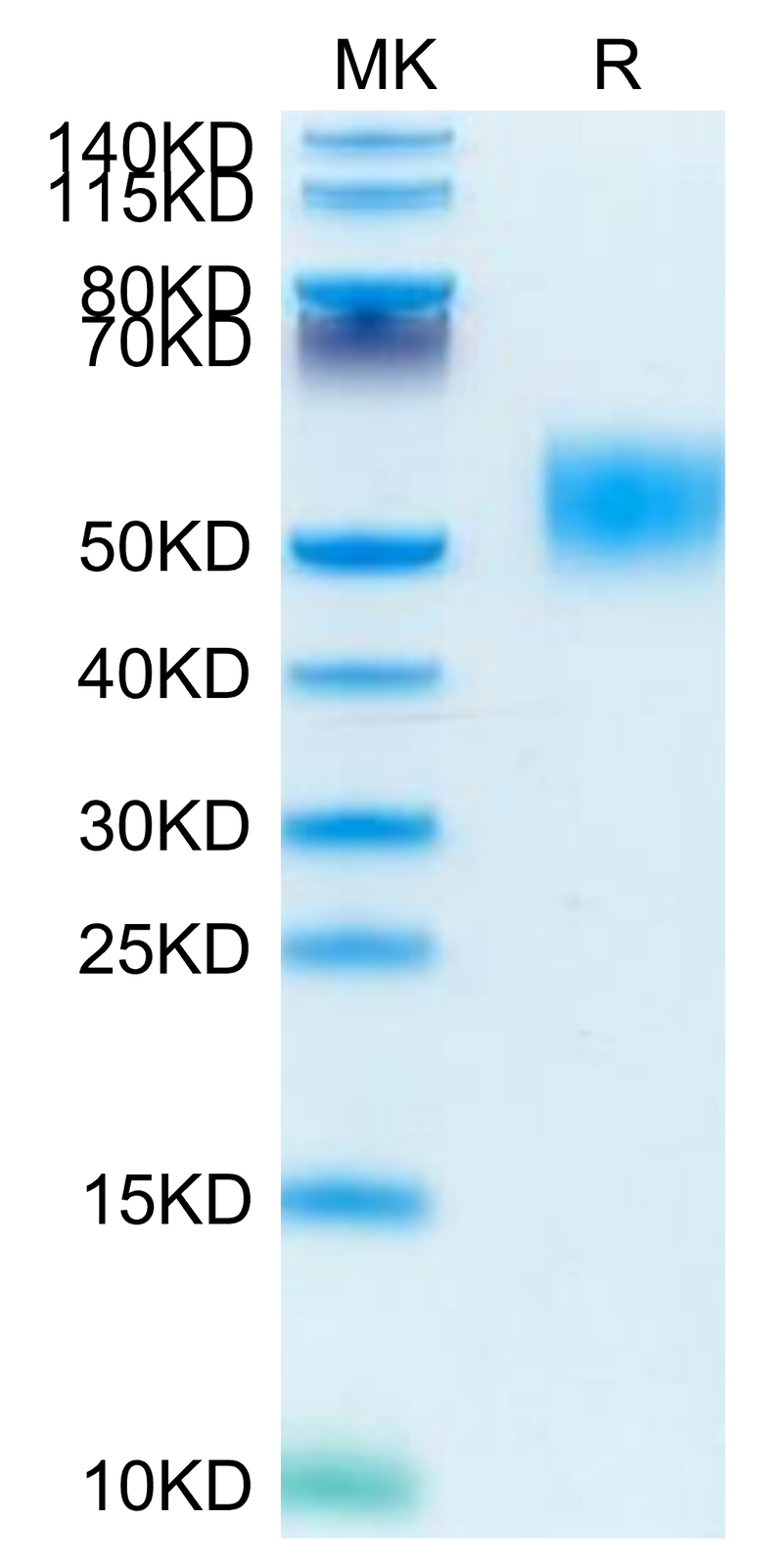 Mouse GM-CSF R alpha on Tris-Bis PAGE under reduced condition. The purity is greater than 95%.Recombinant Mouse GM-CSF R alpha Protein, Active