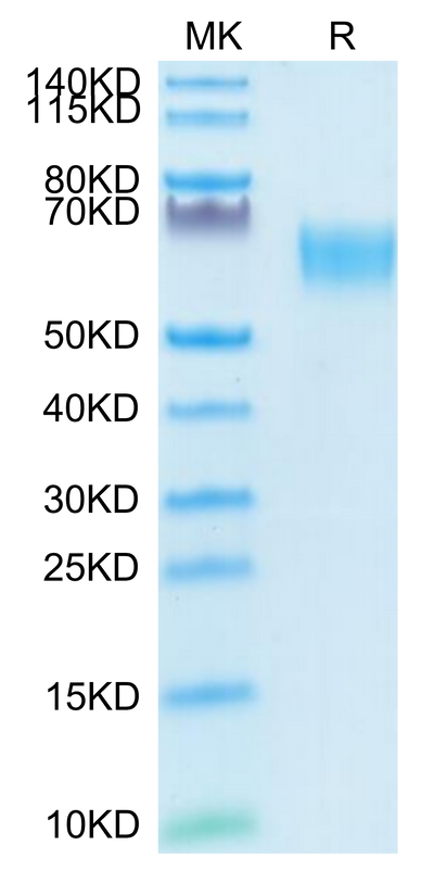 Biotinylated Human TGF-beta RII on Tris-Bis PAGE under reduced condition. The purity is greater than 95%.Biotinylated Human TGF-beta RII/TGFBR2 Protein, Active