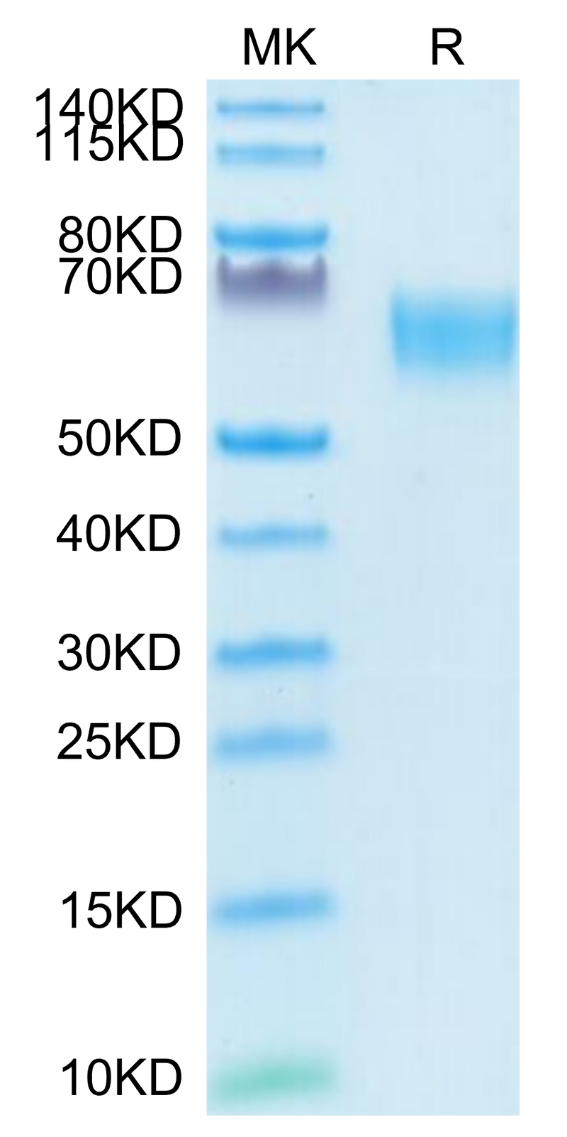 Biotinylated Human TGF-beta RII on Tris-Bis PAGE under reduced condition. The purity is greater than 95%.Biotinylated Human TGF-beta RII/TGFBR2 Protein, Active