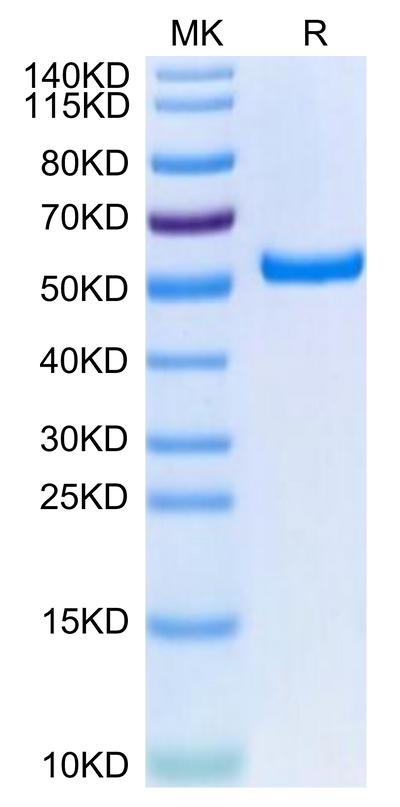Biotinylated Human HLA-A*02:01&B2M&HPV16 E7 (YMLDLQPET) Monomer on Tris-Bis PAGE under reduced condition. The purity is greater than 95%.Biotinylated Human HLA-A*02:01&B2M&HPV16 E7 (YMLDLQPET) Monomer Protein