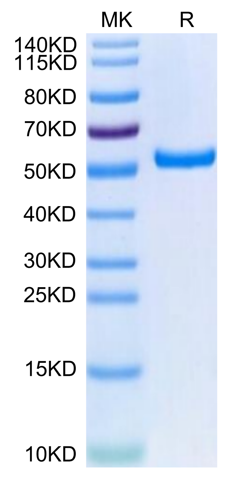 Biotinylated Human HLA-A*02:01&B2M&HPV16 E7 (YMLDLQPET) Monomer on Tris-Bis PAGE under reduced condition. The purity is greater than 95%.Biotinylated Human HLA-A*02:01&B2M&HPV16 E7 (YMLDLQPET) Monomer Protein