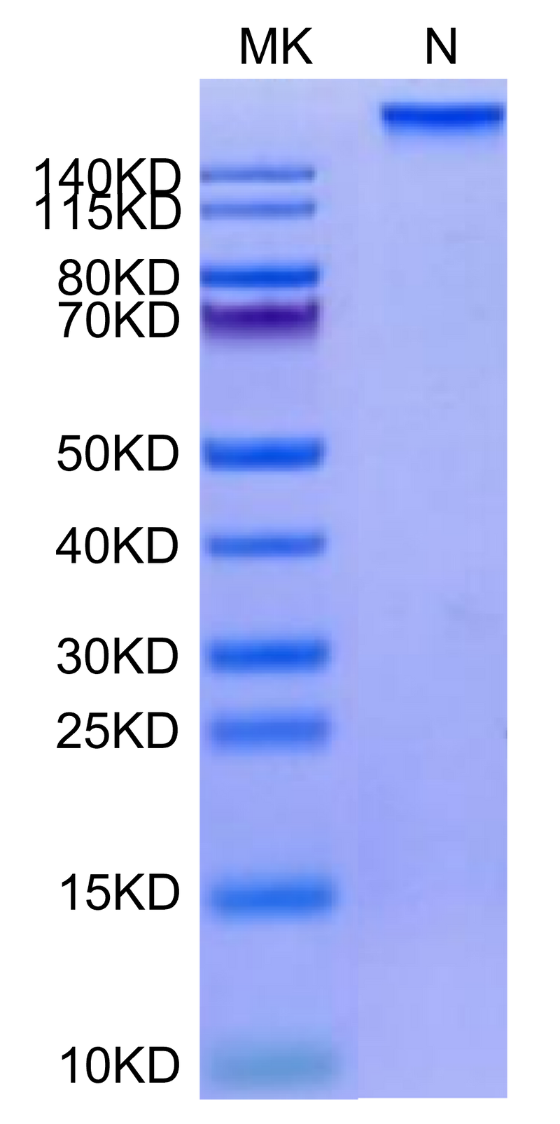 Human HLA-A*02:01&B2M&HPV16 E7 (YMLDLQPET) Tetramer on Tris-Bis PAGE under under Non reducing (N) condition. The purity is greater than 95%.Recombinant Human HLA-A*02:01&B2M&HPV16 E7 (YMLDLQPET) Tetramer Protein