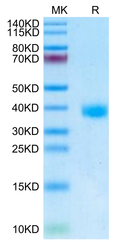 SARS-Cov-2 Spike RBD (Omicron BA.2/BA.2.2.1) on Tris-Bis PAGE under reduced condition. The purity is greater than 95%.Recombinant SARS-Cov-2 Spike RBD (Omicron BA.2/BA.2.2.1) Protein, Active