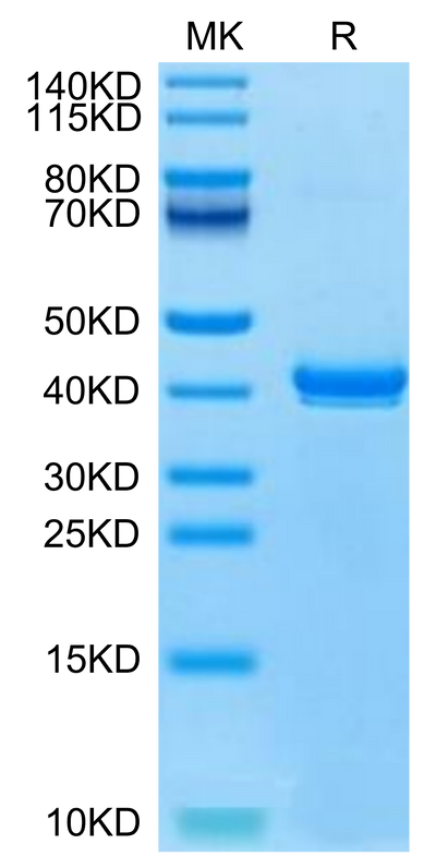 Canine S100B on Tris-Bis PAGE under reduced condition. The purity is greater than 95%.