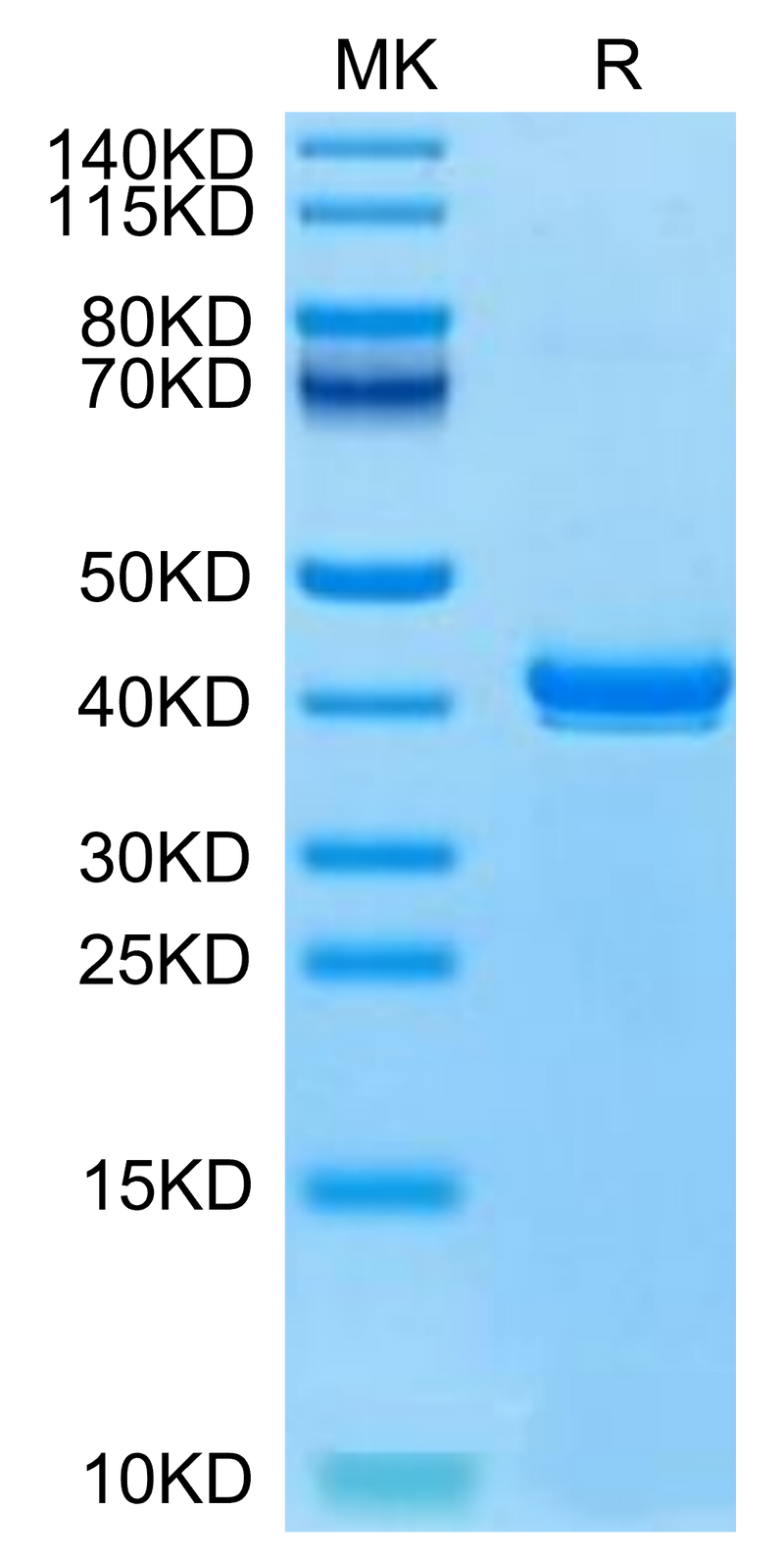 Canine S100B on Tris-Bis PAGE under reduced condition. The purity is greater than 95%.Recombinant Canine S100B Protein