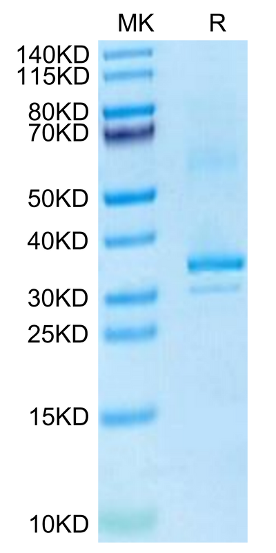 Mouse RANKL on Tris-Bis PAGE under reduced condition. The purity is greater than 95%.Recombinant Mouse RANKL/TNFSF11/CD254 Protein, Active