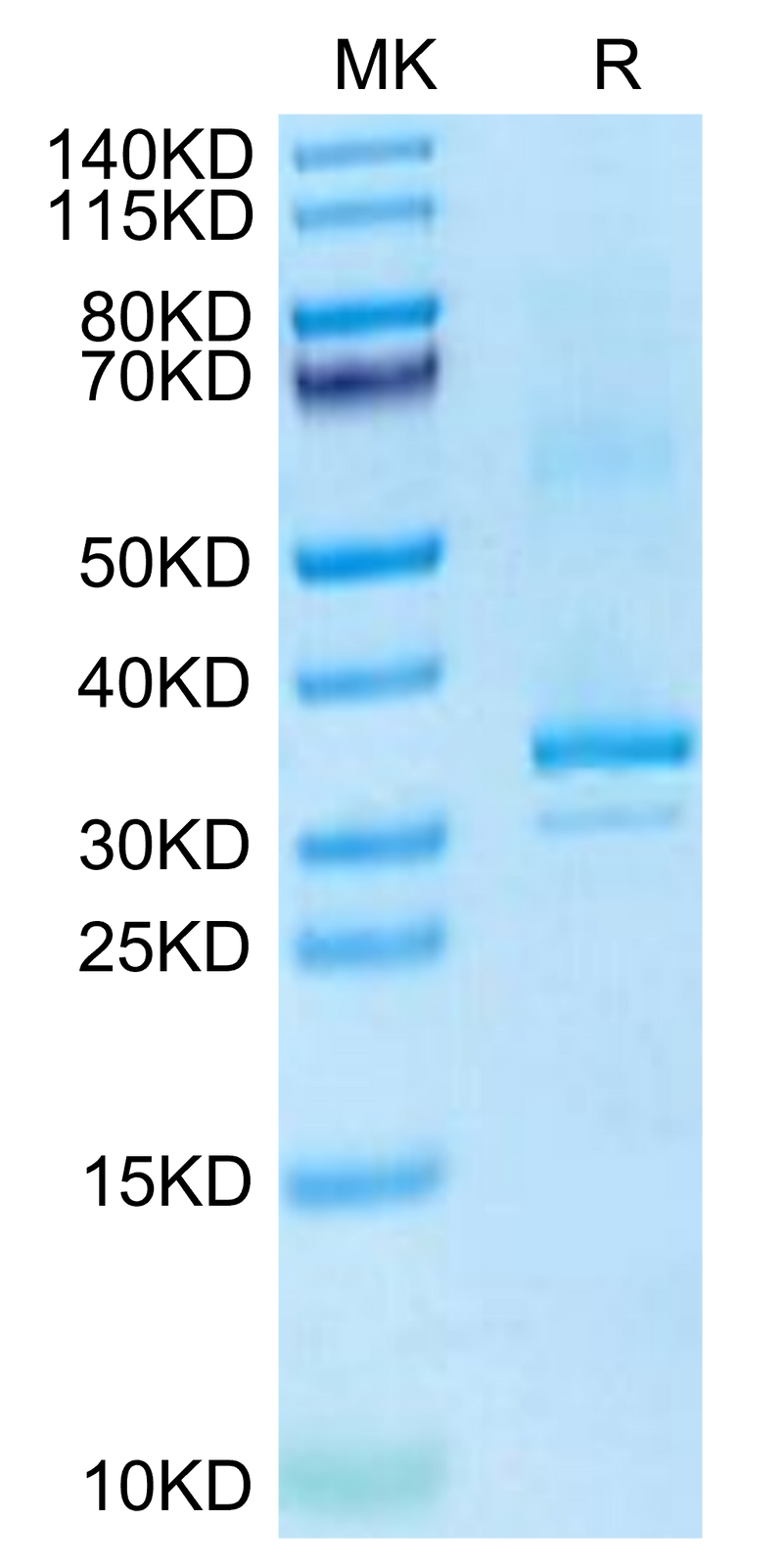 Mouse RANKL on Tris-Bis PAGE under reduced condition. The purity is greater than 95%.Recombinant Mouse RANKL/TNFSF11/CD254 Protein, Active