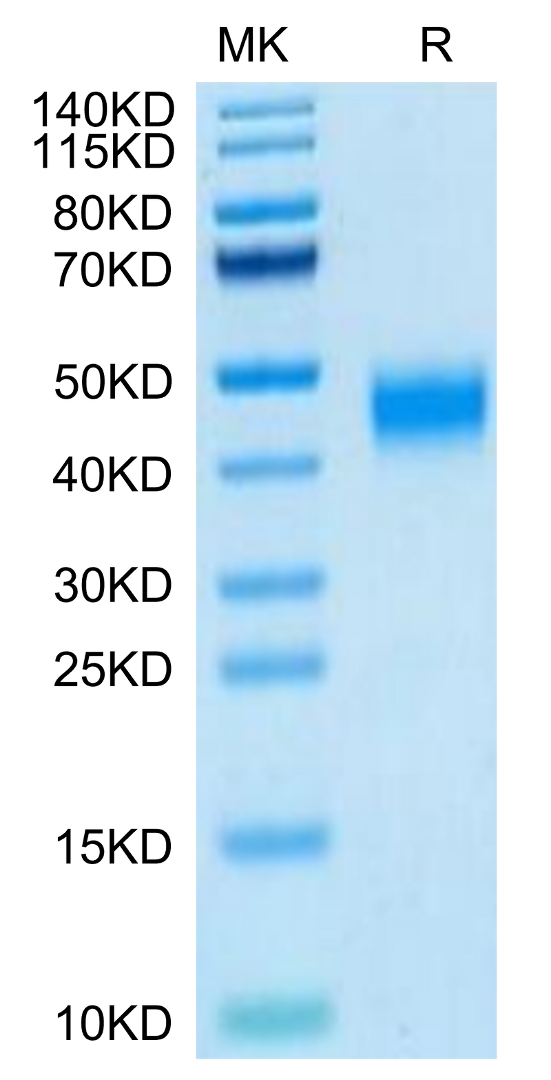Human MXRA8 on Tris-Bis PAGE under reduced condition. The purity is greater than 95%.Recombinant Human MXRA8 Protein