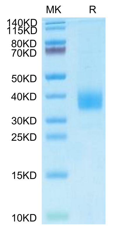 Cynomolgus Siglec-15 on Tris-Bis PAGE under reduced condition. The purity is greater than 95%.Recombinant Cynomolgus Siglec-15/CD33L3 Protein, Active