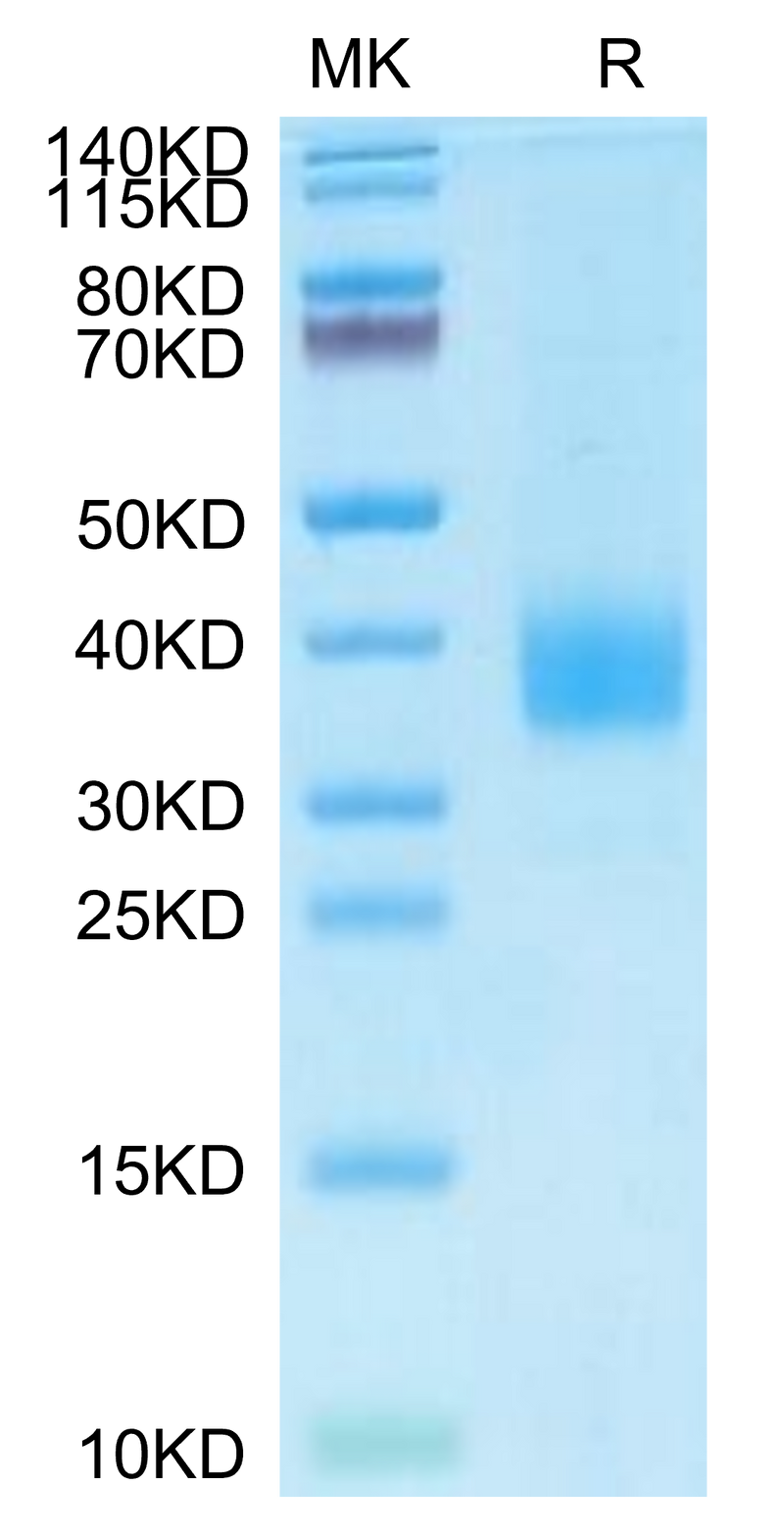 Cynomolgus Siglec-15 on Tris-Bis PAGE under reduced condition. The purity is greater than 95%.Recombinant Cynomolgus Siglec-15/CD33L3 Protein, Active