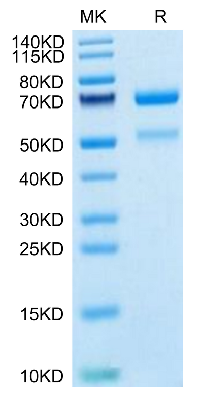 Human CTGF on Tris-Bis PAGE under reduced condition. The purity is greater than 95%.Recombinant Human CTGF/CCN2 Protein, Active