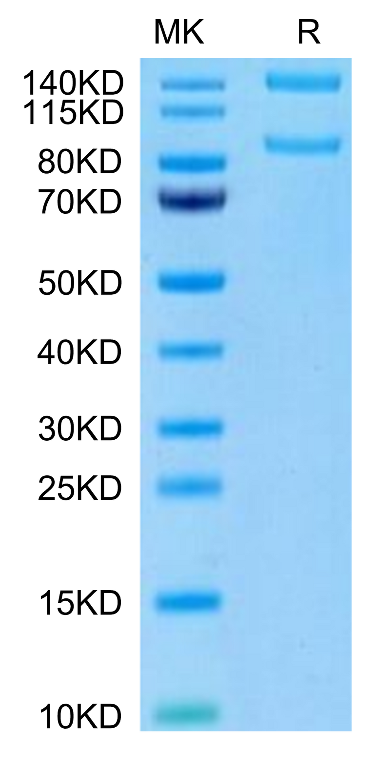 Human ITGAM&ITGB2 on Tris-Bis PAGE under reduced condition. The purity is greater than 95%.Recombinant Human Integrin alpha M beta 2 (ITGAM&ITGB2) Heterodimer Protein, Active