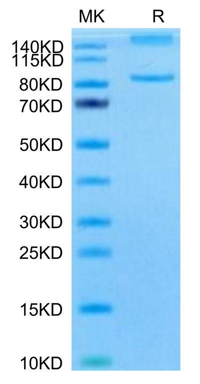 Mouse ITGAL&ITGB2 on Tris-Bis PAGE under reduced condition. The purity is greater than 95%.Recombinant Mouse Integrin alpha L beta 2 (ITGAL&ITGB2) Heterodimer Protein