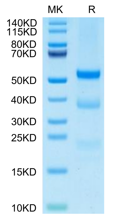 Cynomolgus PLAU (active form) on Tris-Bis PAGE under reduced condition. The purity is greater than 95%.Recombinant Cynomolgus PLAU/uPA Protein (active form), Active