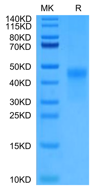 Cynomolgus CD7 on Tris-Bis PAGE under reduced condition. The purity is greater than 95%.Recombinant Cynomolgus CD7 Protein, Active
