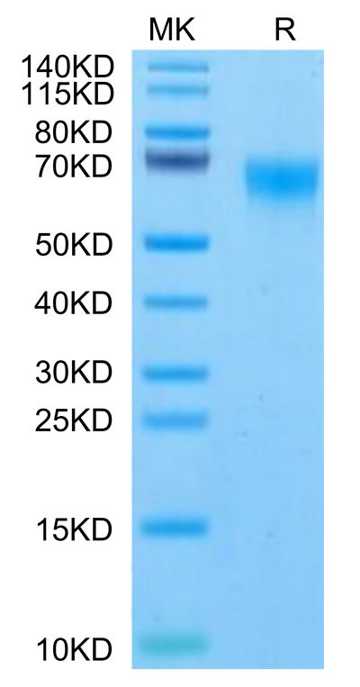 Rhesus macaque FGFR4 on Tris-Bis PAGE under reduced condition. The purity is greater than 95%.Recombinant Rhesus macaque FGFR4 Protein
