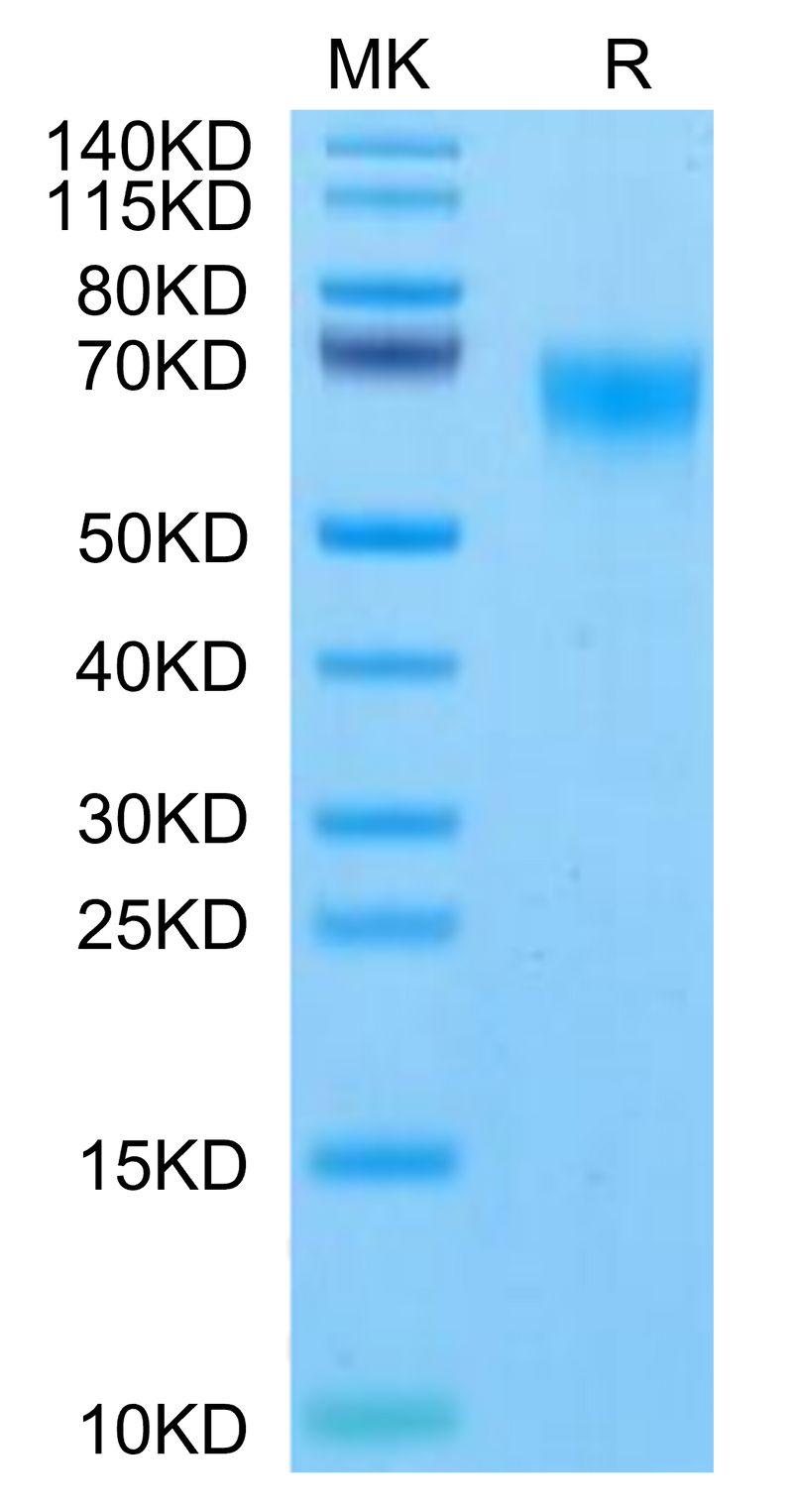 Rhesus macaque FGFR4 on Tris-Bis PAGE under reduced condition. The purity is greater than 95%.Recombinant Rhesus macaque FGFR4 Protein