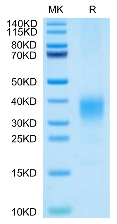 Cynomolgus IL-22 on Tris-Bis PAGE under reduced condition. The purity is greater than 95%.Recombinant Cynomolgus IL-22 Protein, Active