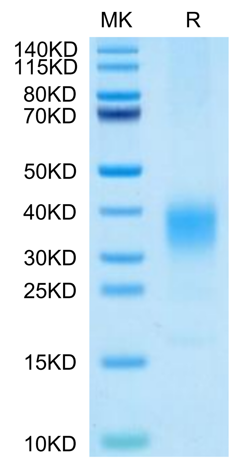Cynomolgus IL-22 on Tris-Bis PAGE under reduced condition. The purity is greater than 95%.Recombinant Cynomolgus IL-22 Protein, Active