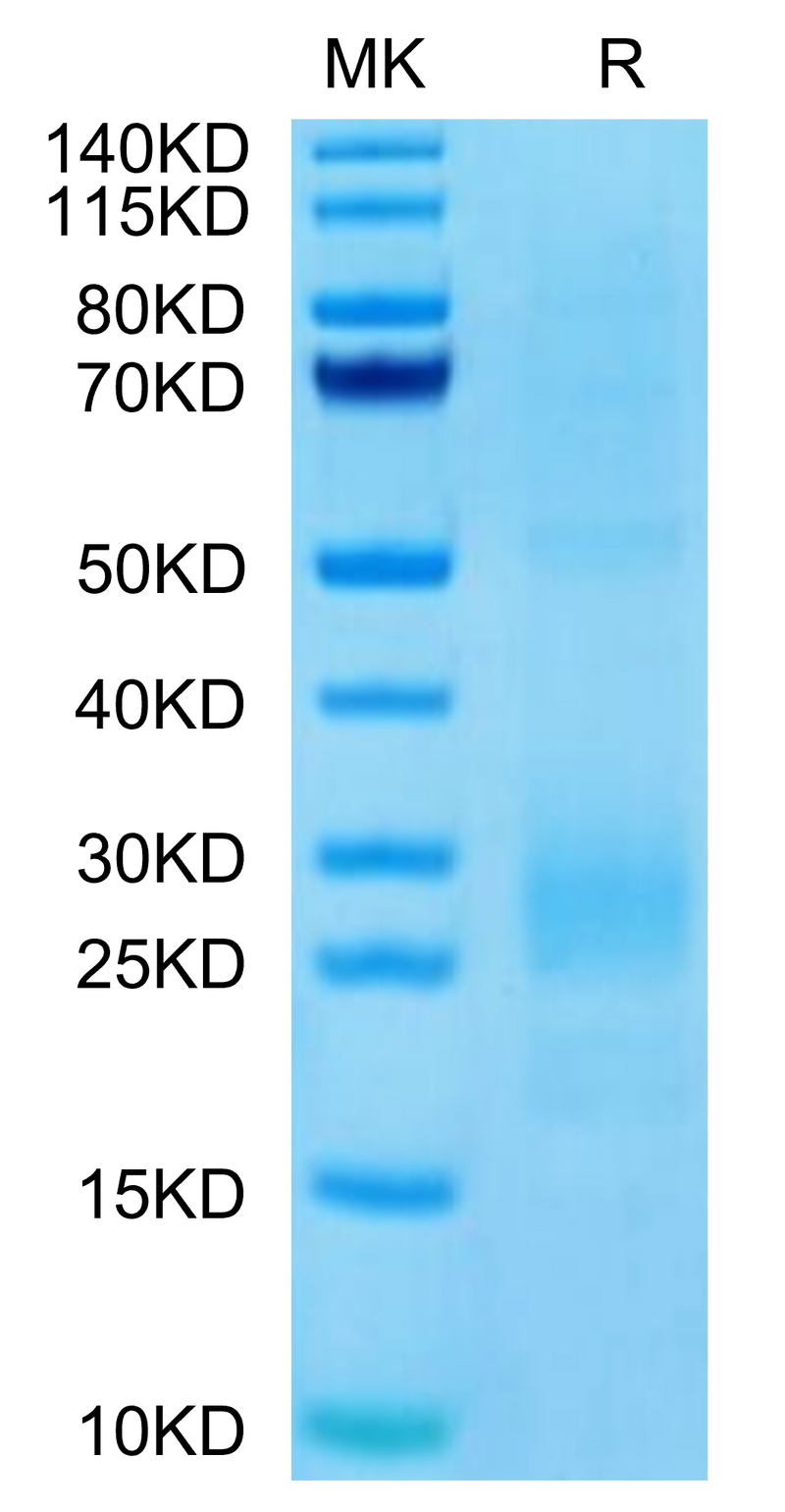 Human MIF on Tris-Bis PAGE under reduced condition. The purity is greater than 95%.Recombinant Human MIF Protein
