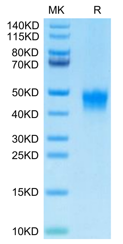 Biotinylated Human DKK1 on Tris-Bis PAGE under reduced condition. The purity is greater than 95%.Biotinylated Human DKK1 Protein, Active