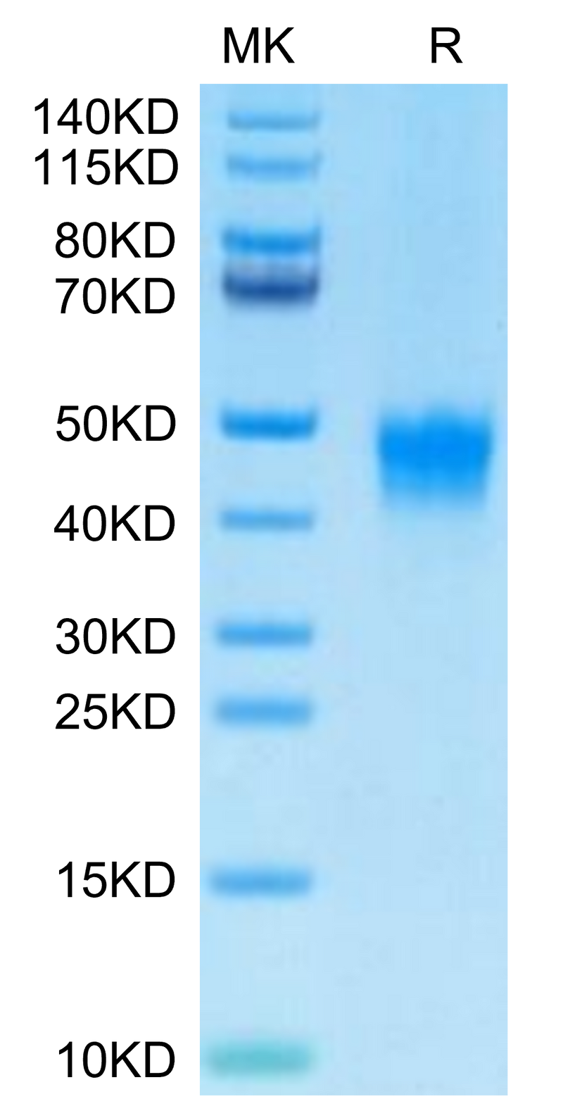 Biotinylated Human DKK1 on Tris-Bis PAGE under reduced condition. The purity is greater than 95%.Biotinylated Human DKK1 Protein, Active