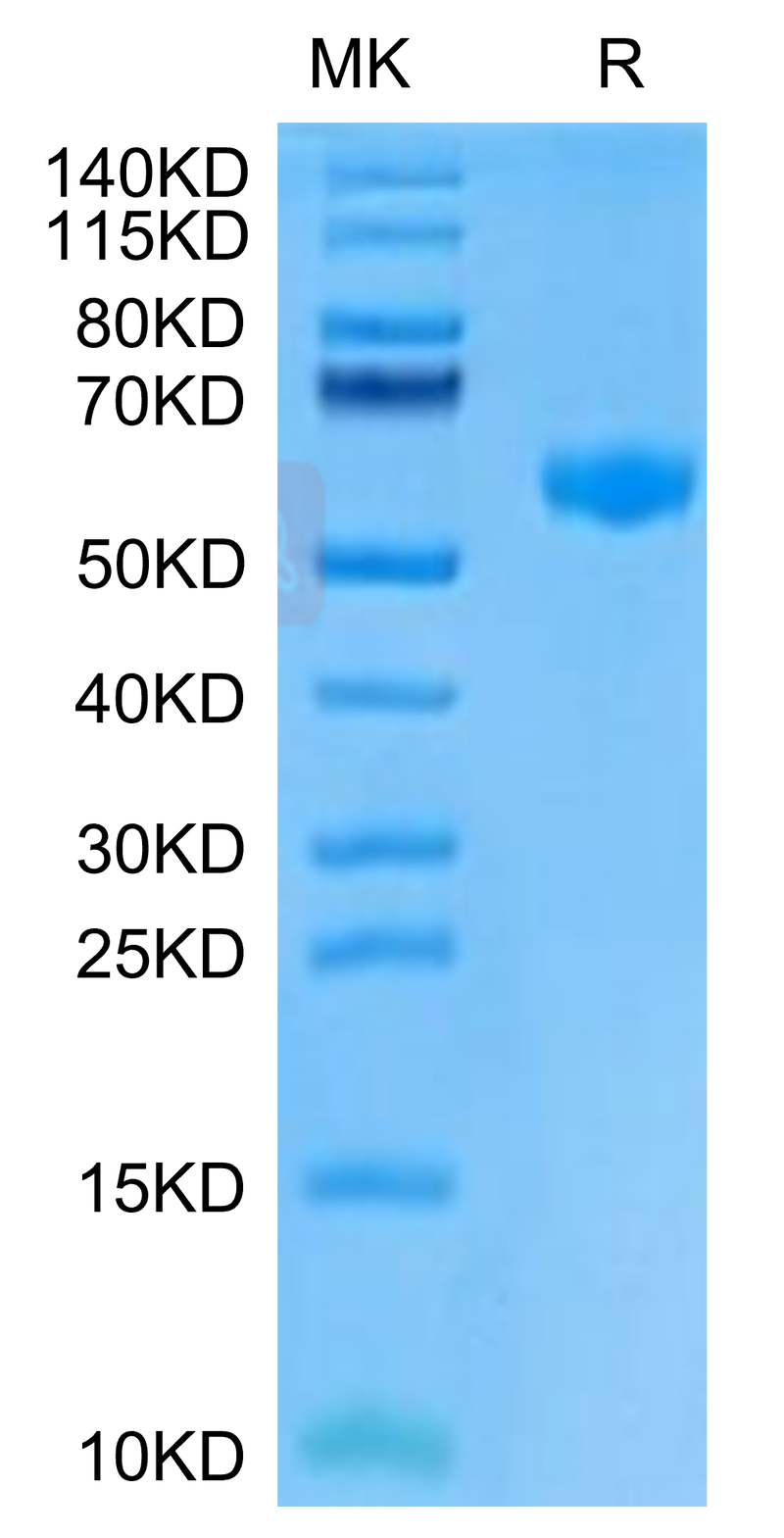 Mouse PVRIG on Tris-Bis PAGE under reduced condition. The purity is greater than 95%.Recombinant Mouse PVRIG Protein, Active