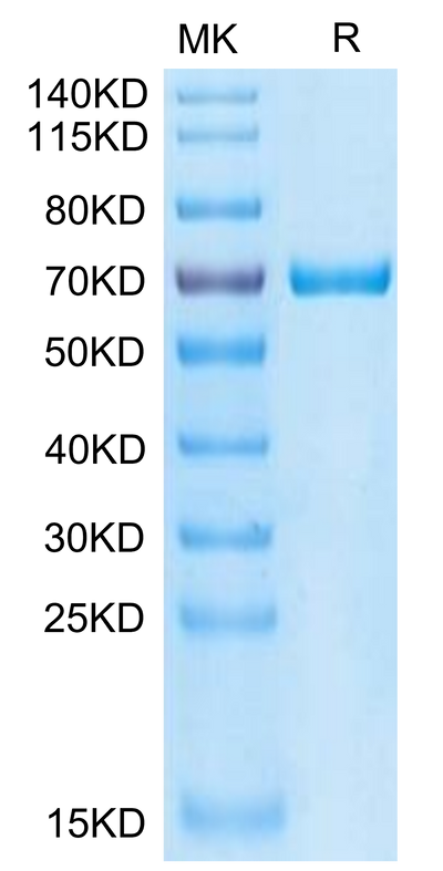 Cynomolgus GAS6 on Tris-Bis PAGE under reduced condition. The purity is greater than 95%.Recombinant Cynomolgus GAS6 Protein, Active