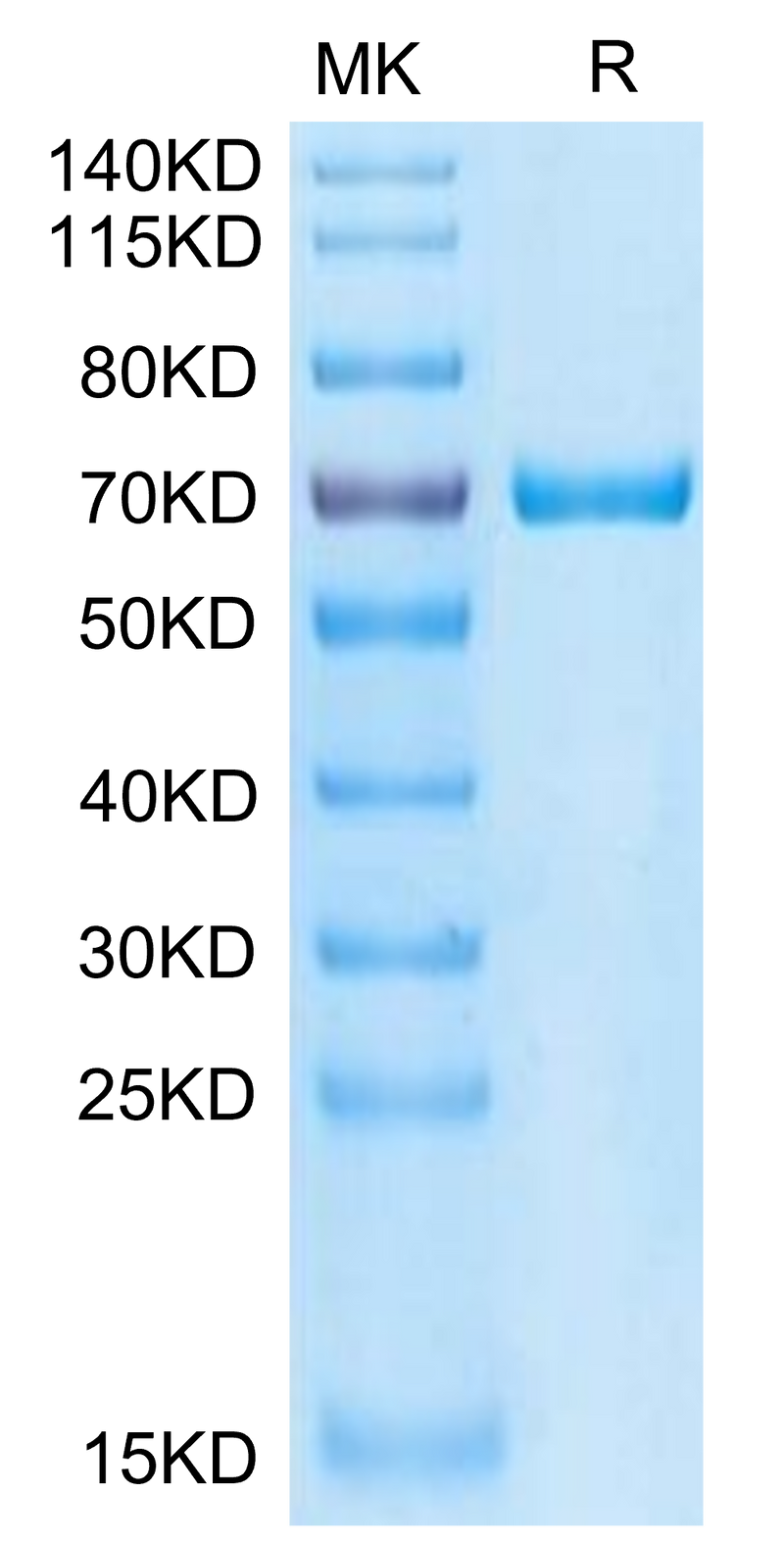 Cynomolgus GAS6 on Tris-Bis PAGE under reduced condition. The purity is greater than 95%.Recombinant Cynomolgus GAS6 Protein, Active