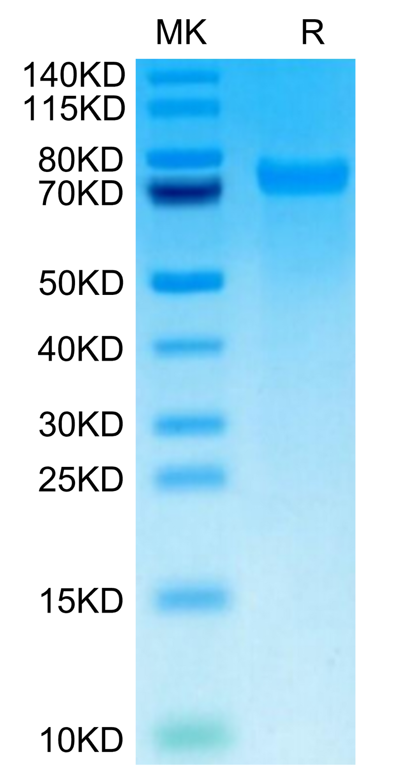 Mouse Tenascin on Tris-Bis PAGE under reduced condition. The purity is greater than 95%.Recombinant Mouse Tenascin Protein
